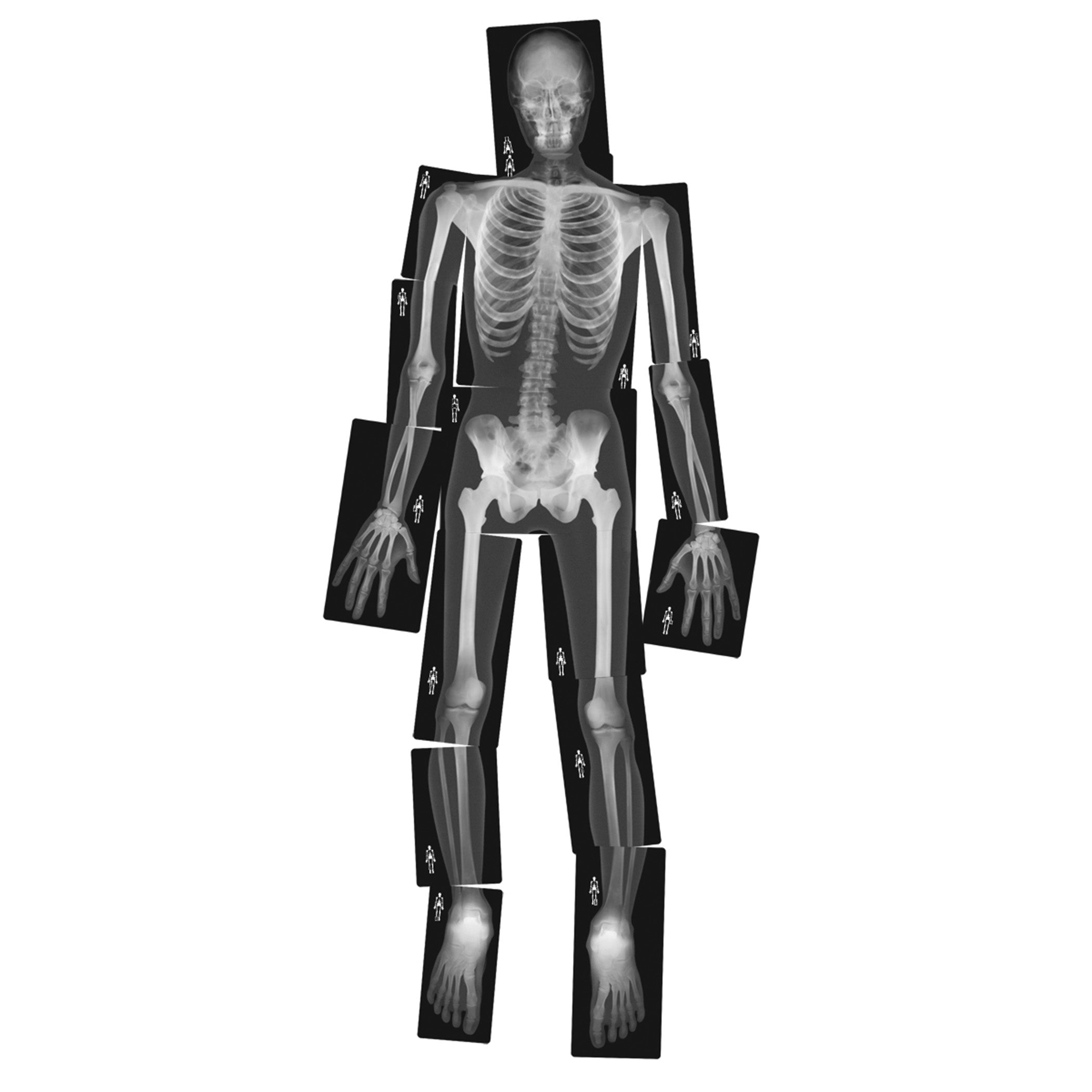 True to Life Human X-Ray Set, Pack of 18