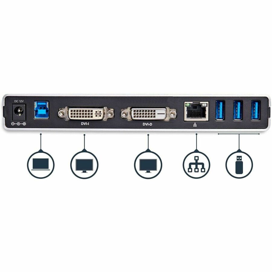 StarTech.com Dual-Monitor USB 3.0 Docking Station with DVI and Vertical Stand