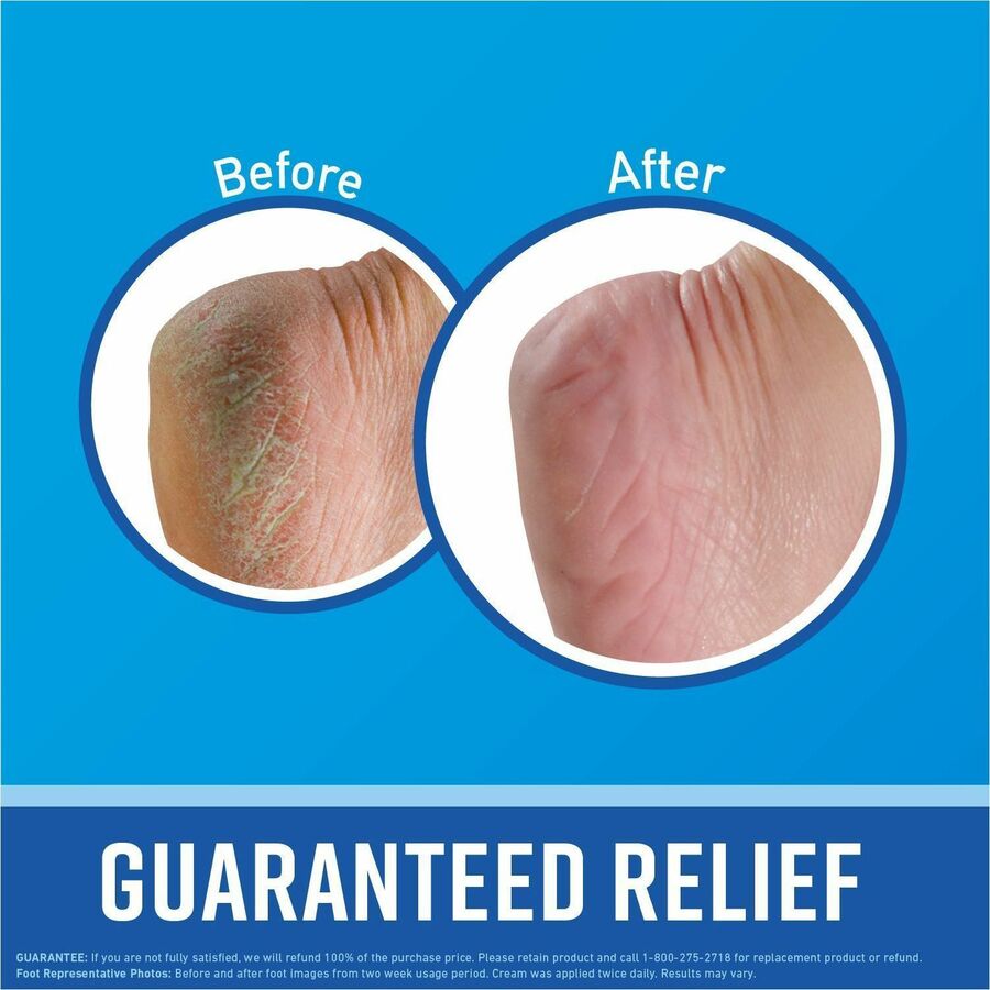 O'Keeffe's Healthy Feet 3.2 Oz. Jar Cream Lotion