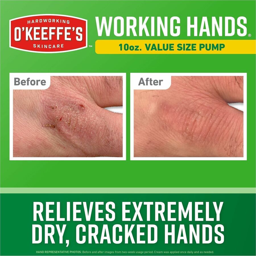 Cream - For Dry Skin - Applicable on Hand - Skin - Moisturising, Non-greasy, Unscented - 1 Each
