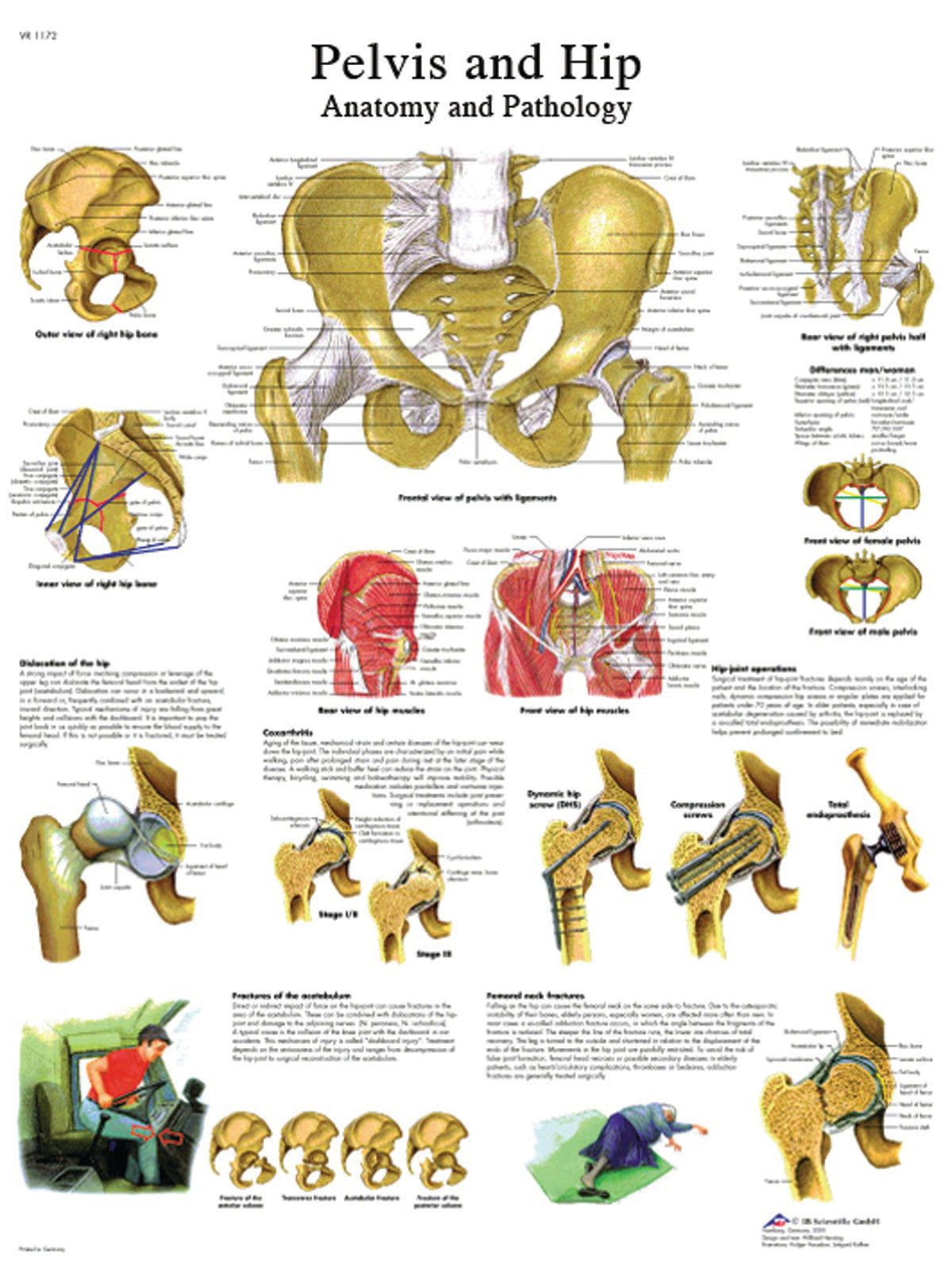 Anatomical Chart - hip & pelvis, laminated