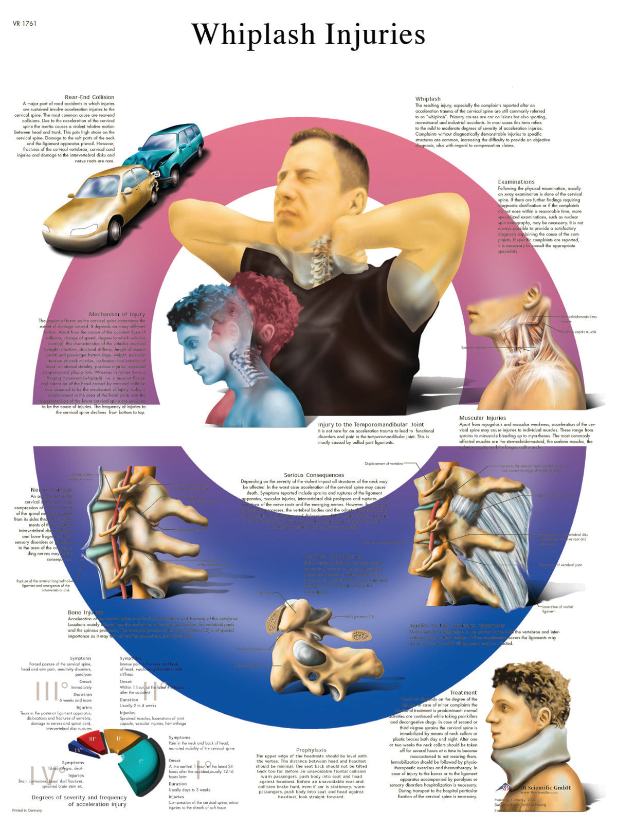 Anatomical chart: whiplash, paper