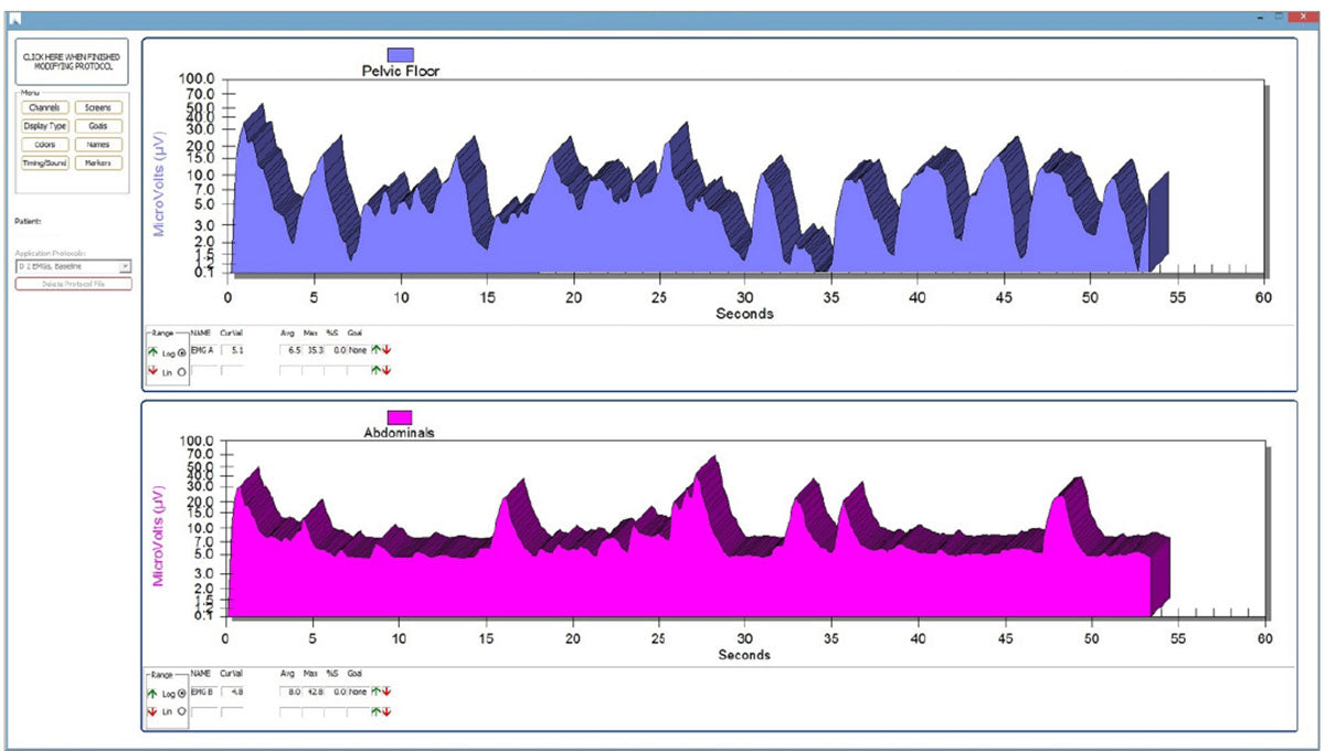 Telesis Software for the Pathway MR Series