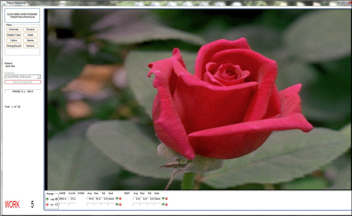 Telesis Software for the Pathway MR Series