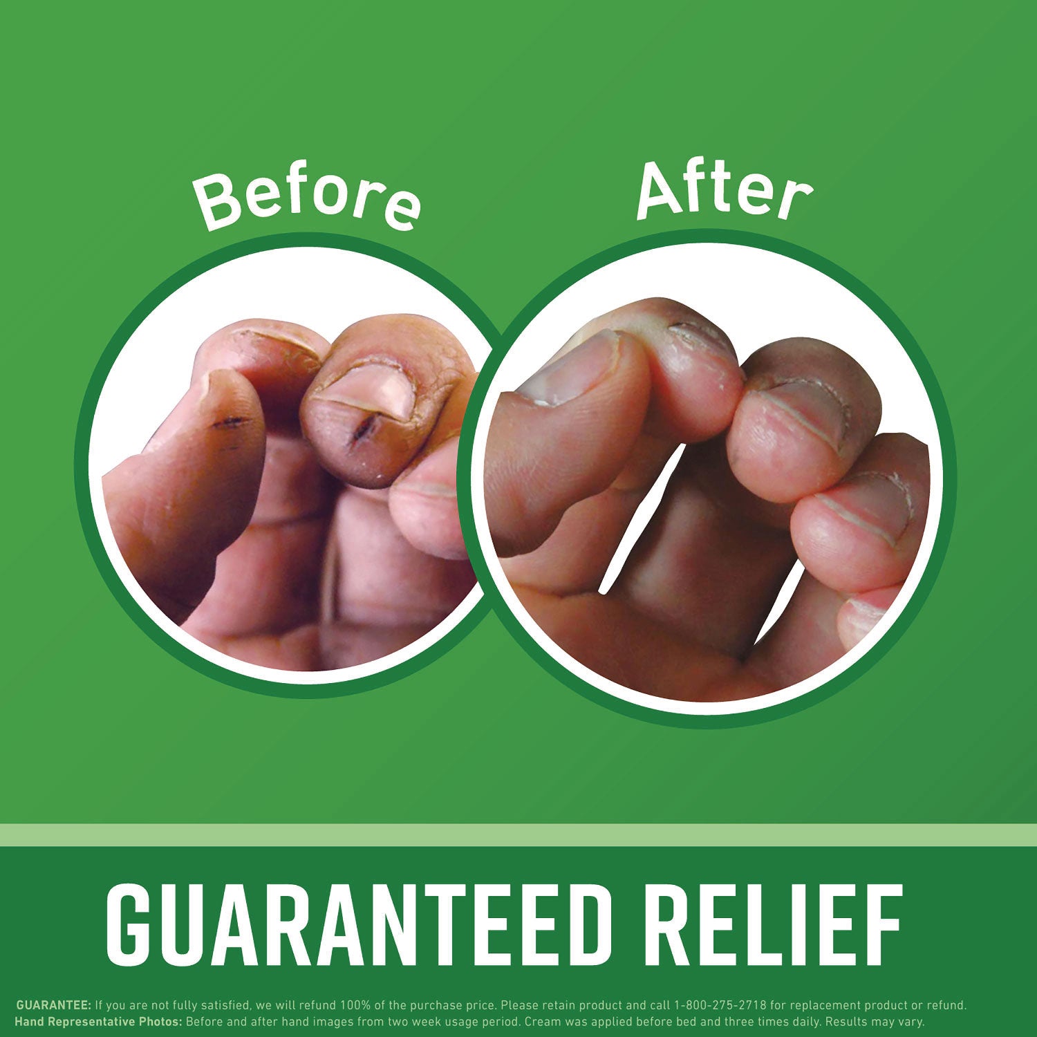 O'Keeffe's Working Hands Hand Cream - Cream - 3.40 fl oz - For Dry Skin - Applicable on Hand - Cracked/Scaly Skin - Moisturising - 1 Each