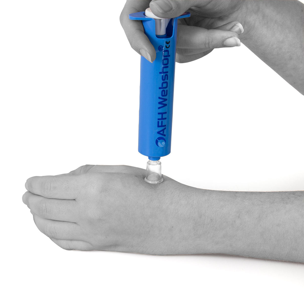 AFH mini cupping kit, standard