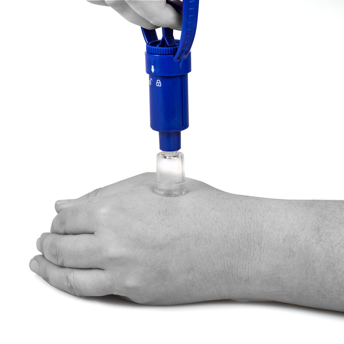 AFH mini cupping kit with dynamic pump