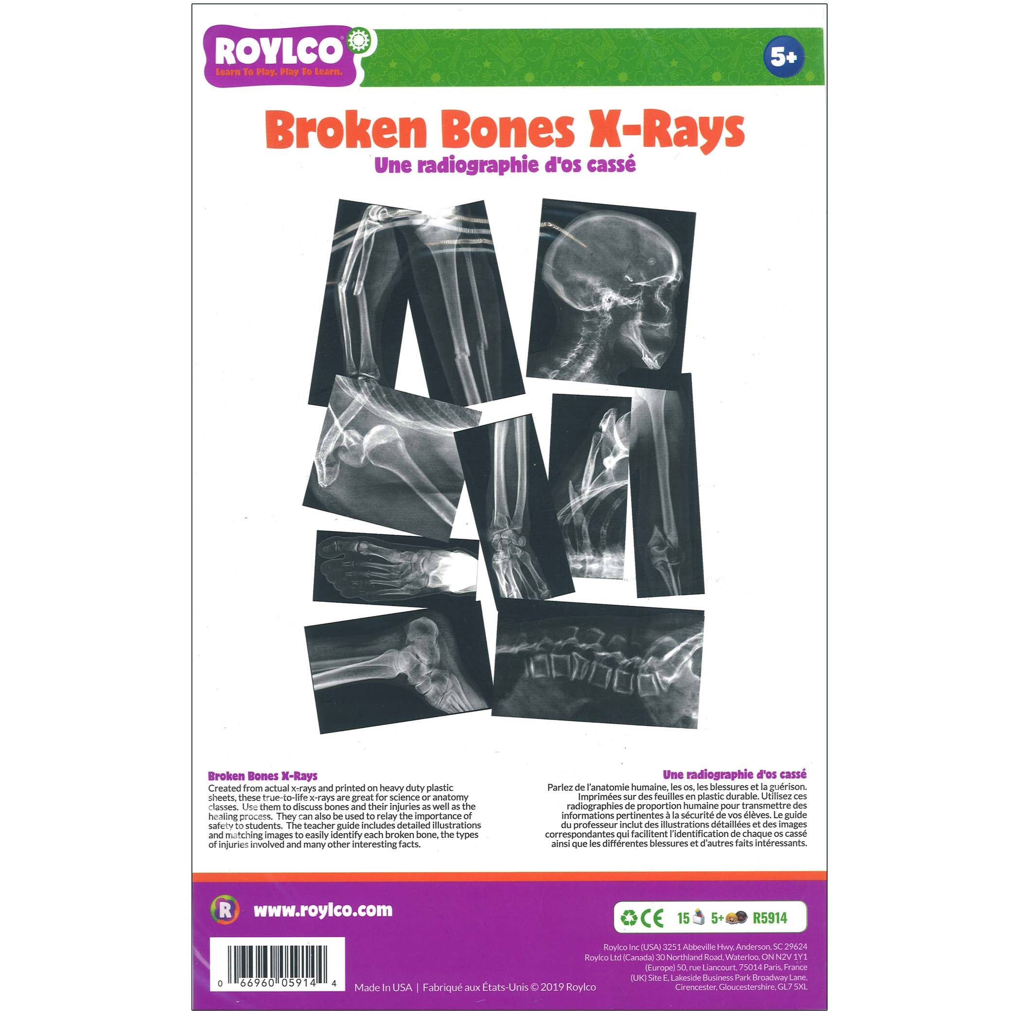 Broken Bones X-Ray Set, Pack of 15