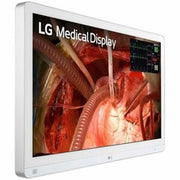 LG 27HQ710S-W 27&amp;quot; Class 4K UHD LED Monitor - 16:9