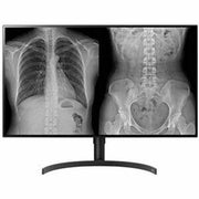 LG 32HL512D-B 32&amp;quot; Class 4K UHD LCD Monitor - 16:9 - Black - TAA Compliant