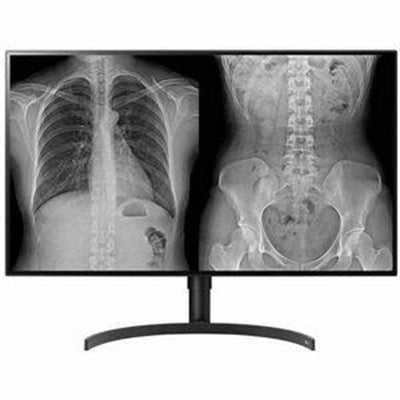 LG 32HL512D-B 32&amp;quot; Class 4K UHD LCD Monitor - 16:9 - Black - TAA Compliant