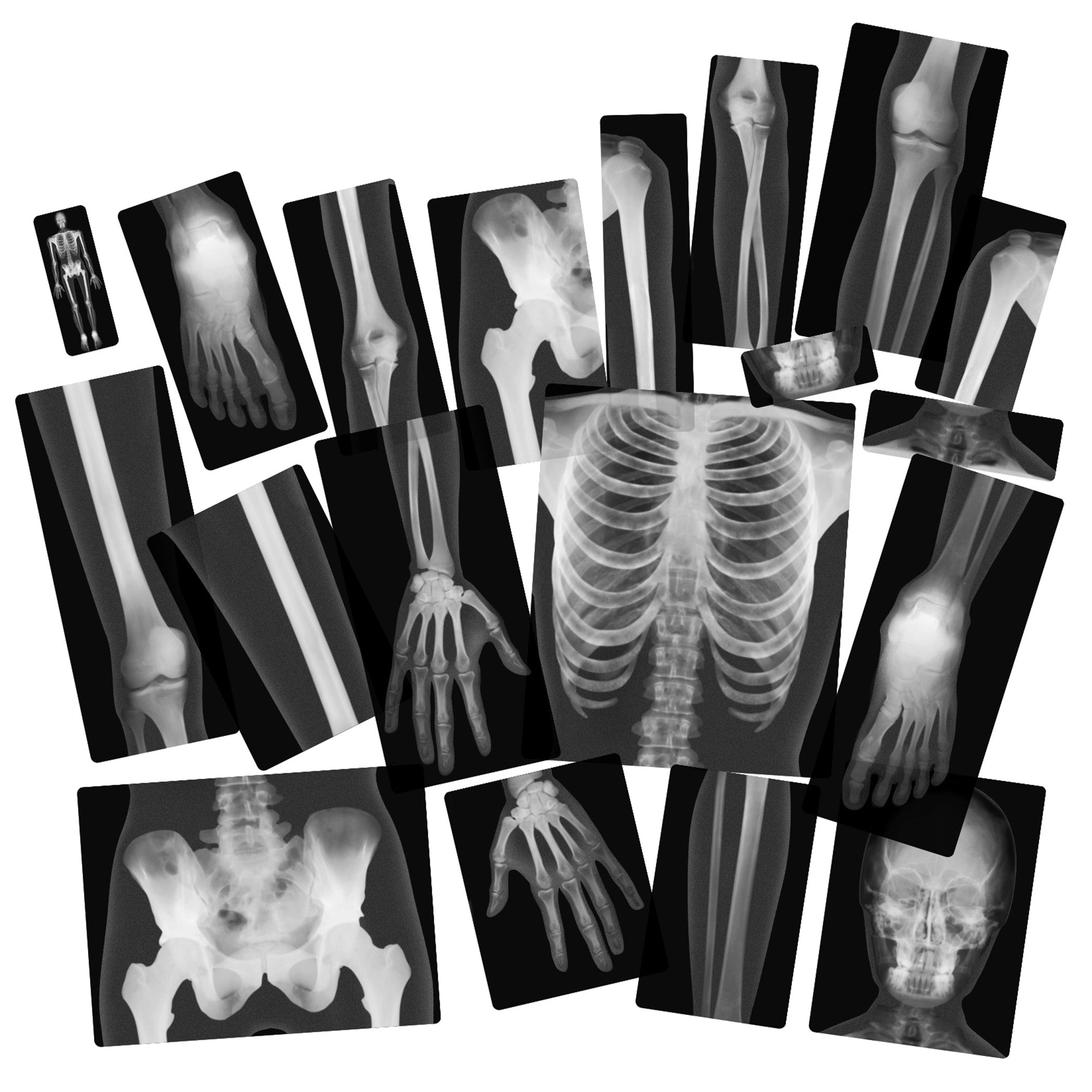 True to Life Human X-Ray Set, Pack of 18