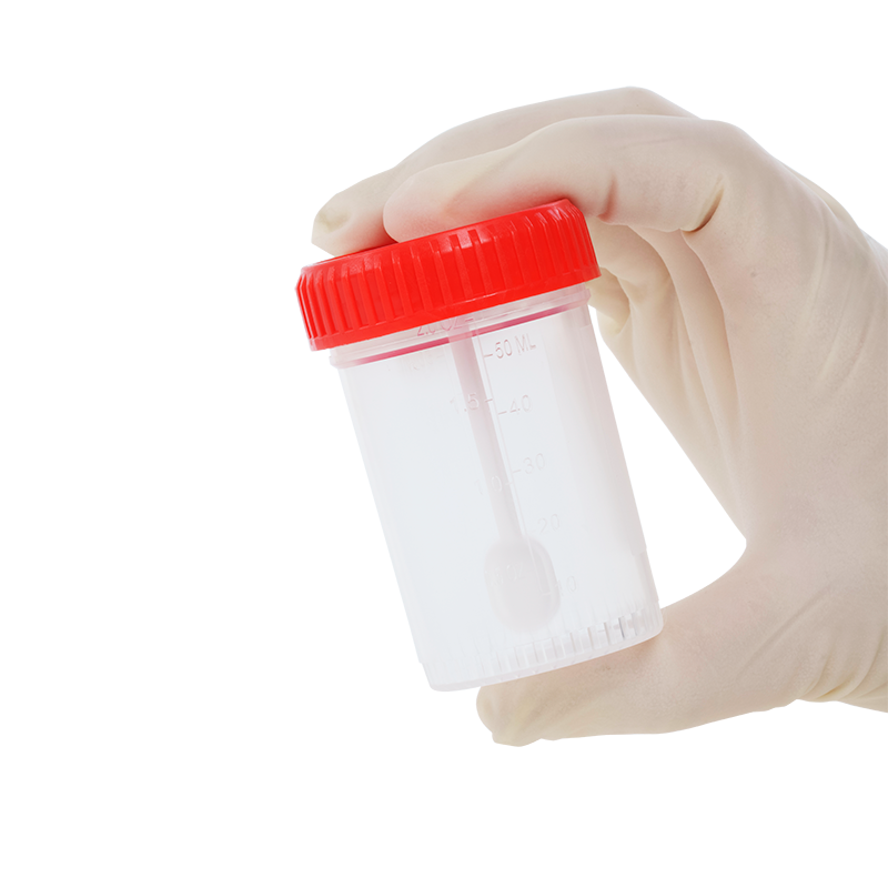 Stool Specimen Container with Spoon, Sterile, 60 mL - 400 pcs per Case