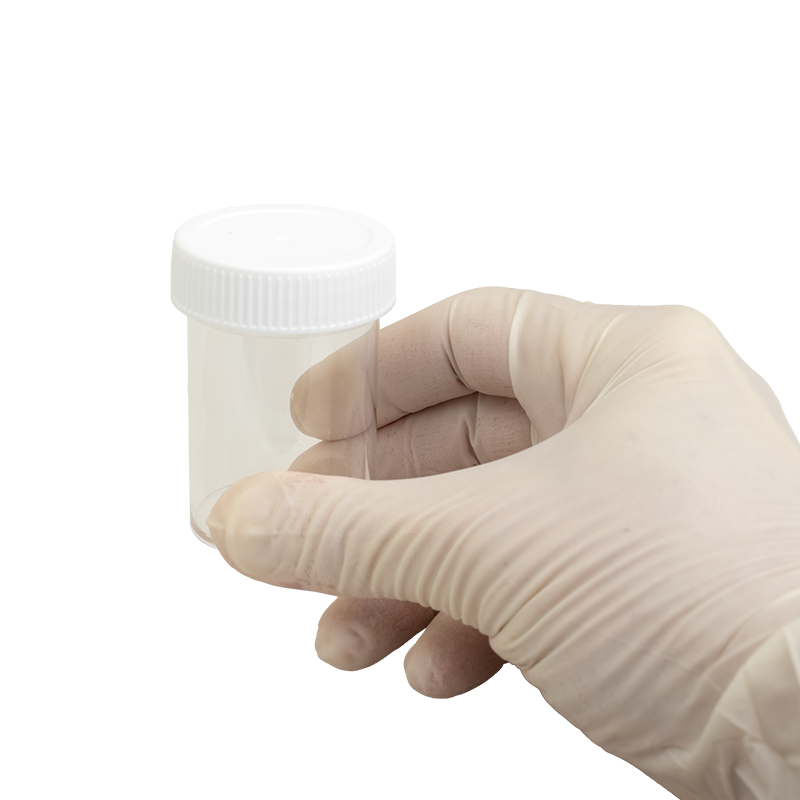 Specimen Container, Non-Sterile, 60 mL - 500 pcs per Case