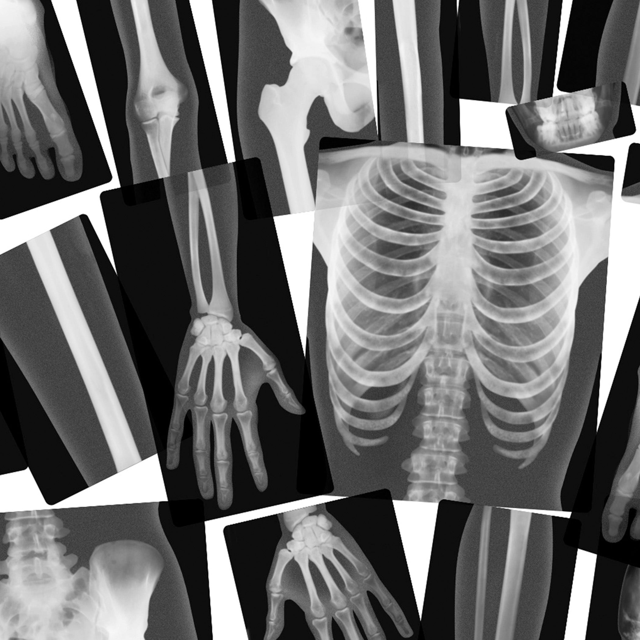 True to Life Human X-Ray Set, Pack of 18