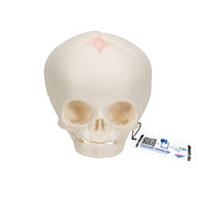 Foetal Skull Model, Natural Cast, 30th Week of Pregnancy