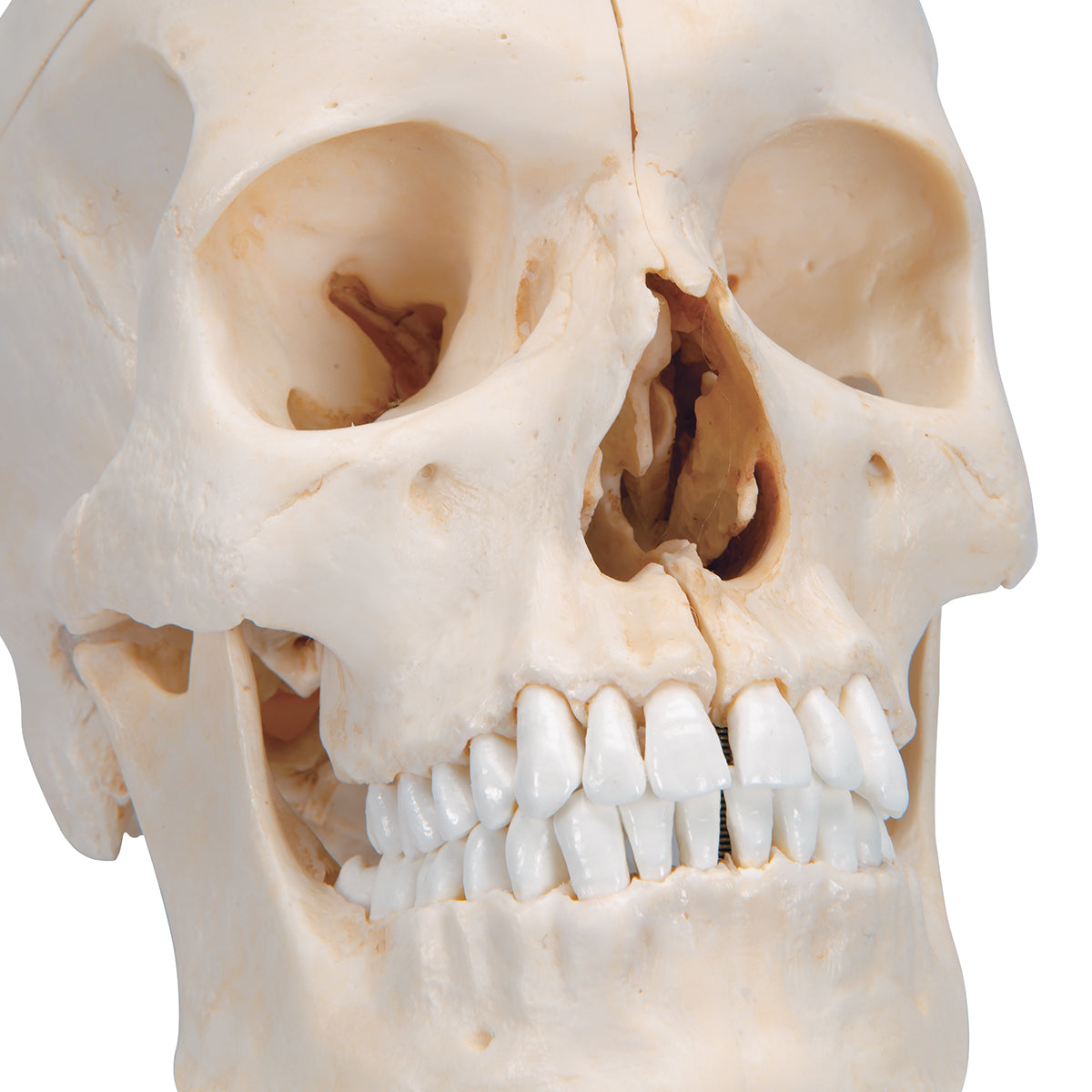 BONElike Human Bony Skull Model, 6 part