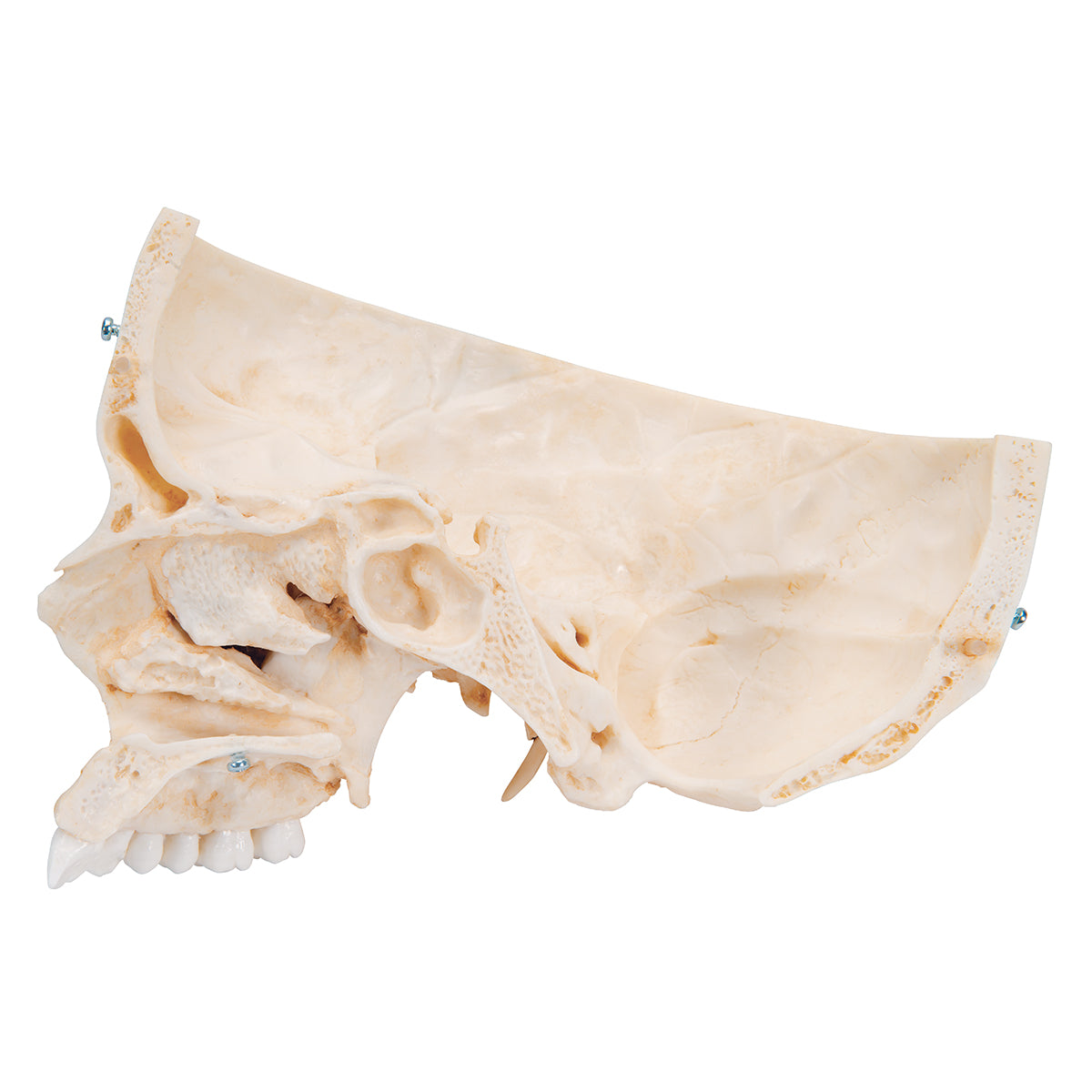 BONElike Human Bony Skull Model, 6 part