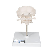Atlas & Axis Model with Occipital Plate, Wire Mounted, on Removable Stand
