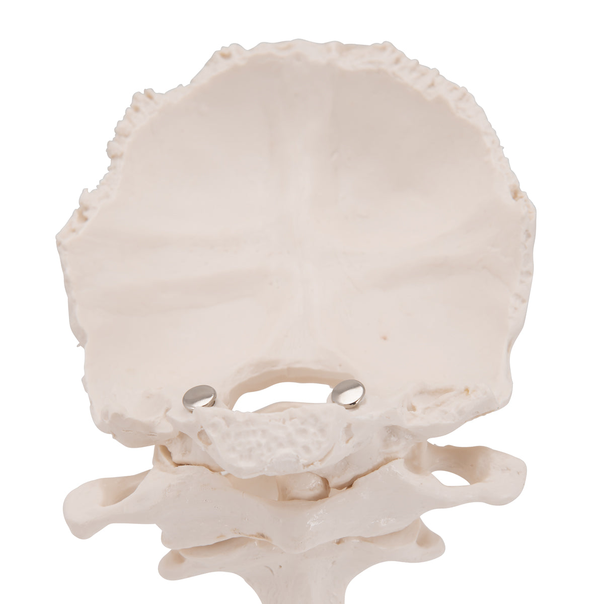 Atlas & Axis Model with Occipital Plate, Wire Mounted, on Removable Stand