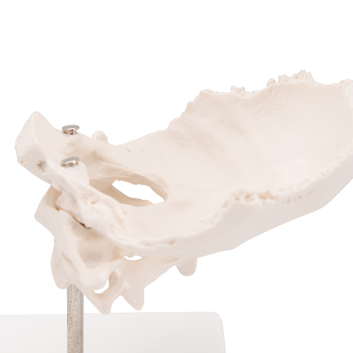 Atlas & Axis Model with Occipital Plate, Wire Mounted, on Removable Stand