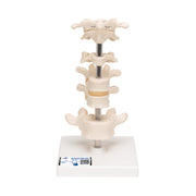Model of 6 Human Vertebrae, Mounted on Stand (atlas, axis, cervical, 2x thoracic, lumbar)