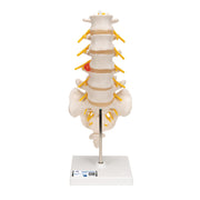 Human Lumbar Spinal Column Model with Dorso-Lateral Prolapsed Intervertebral Disc