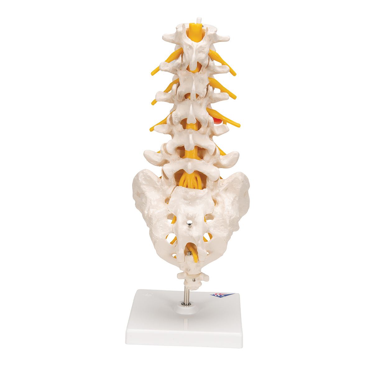 Human Lumbar Spinal Column Model with Dorso-Lateral Prolapsed Intervertebral Disc