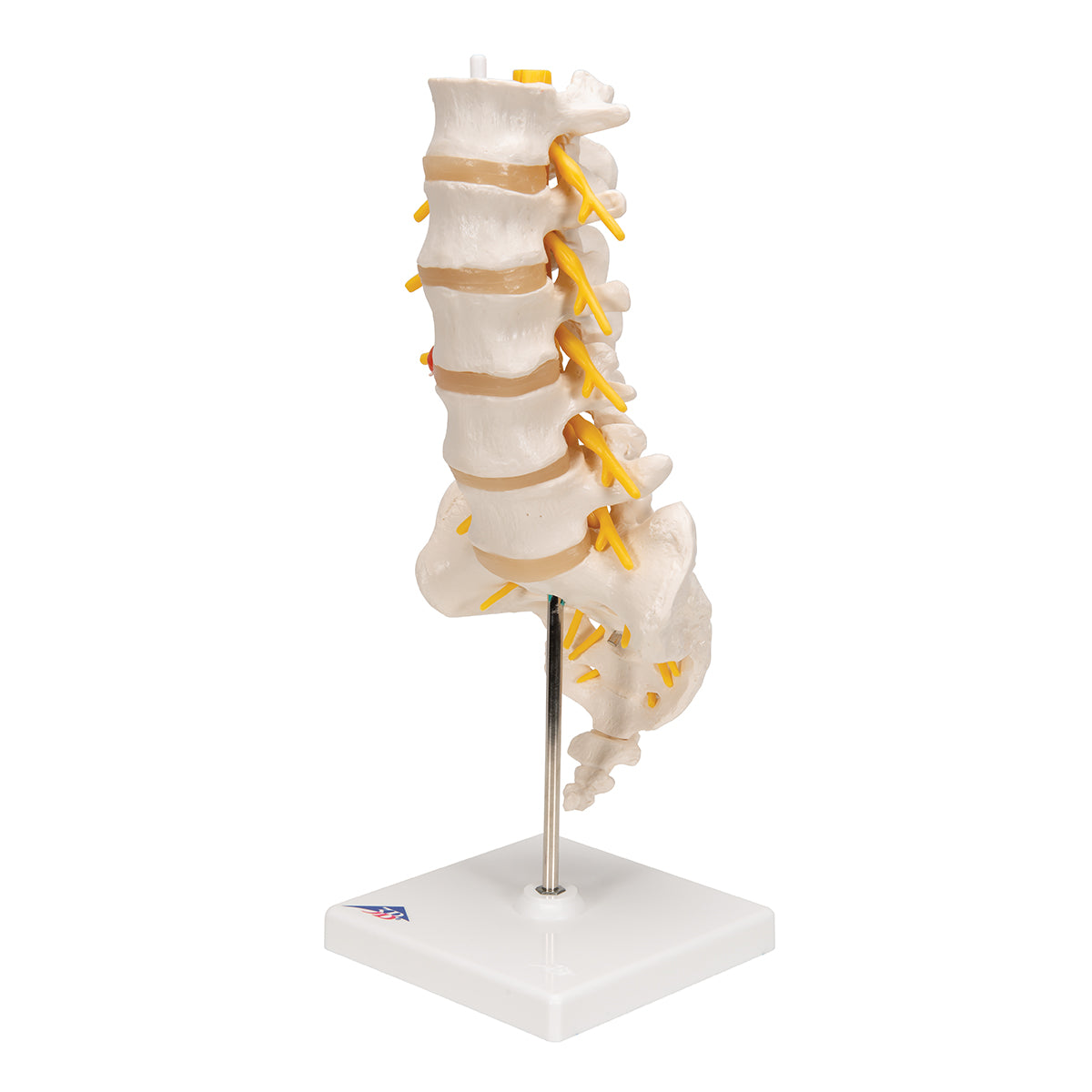 Human Lumbar Spinal Column Model with Dorso-Lateral Prolapsed Intervertebral Disc