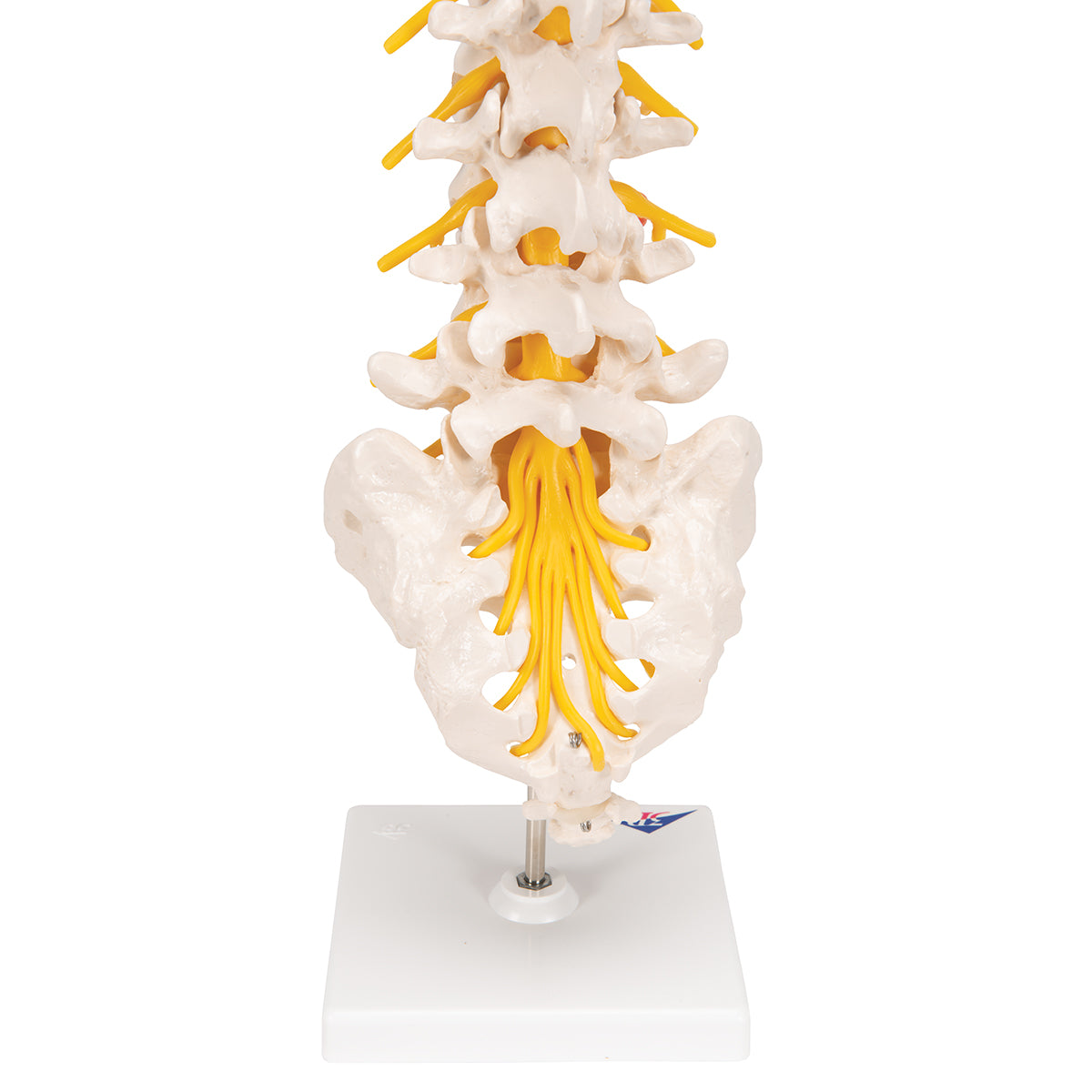 Human Lumbar Spinal Column Model with Dorso-Lateral Prolapsed Intervertebral Disc