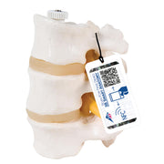 3 Human Lumbar Vertebrae, Flexibly Mounted