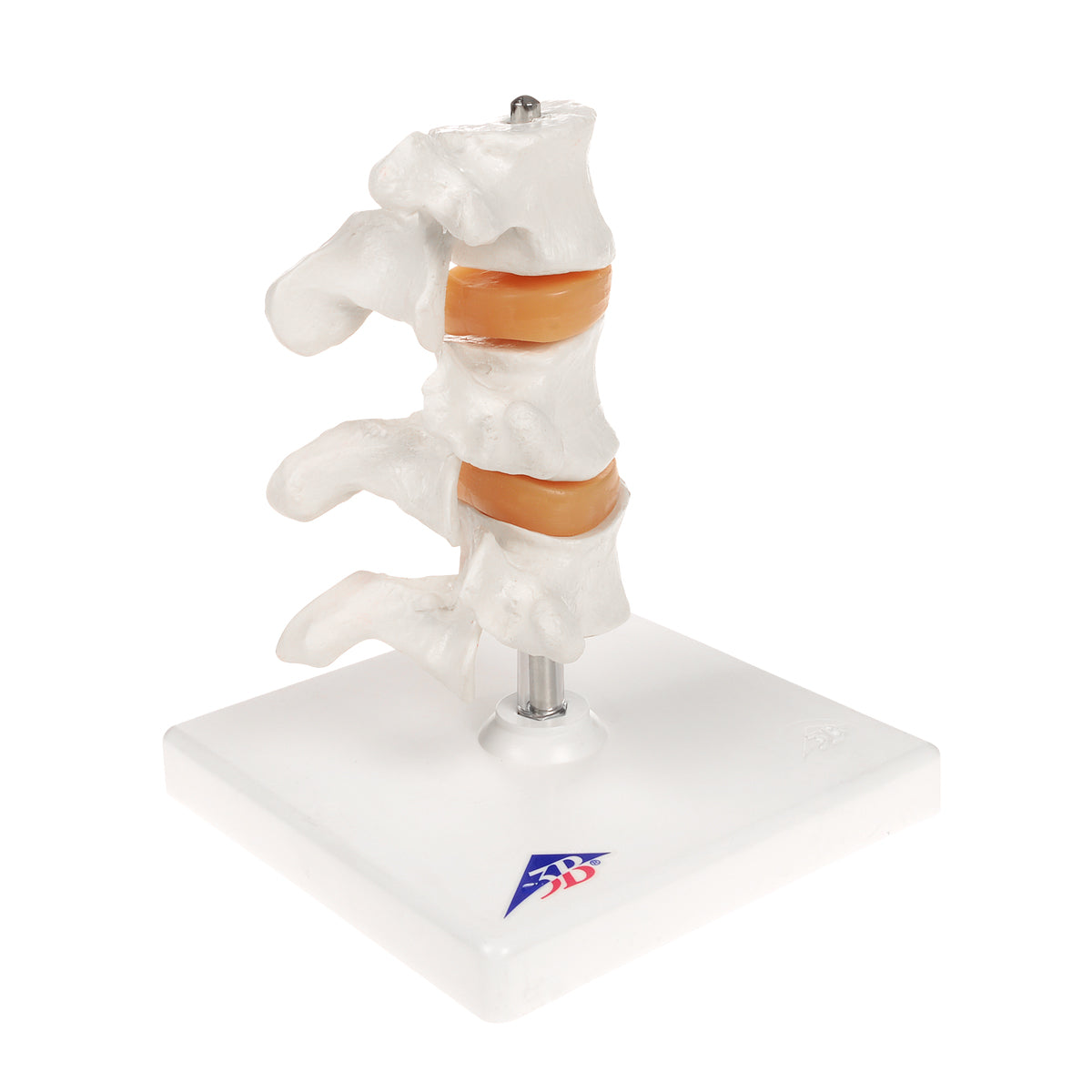 Deluxe Human Osteoporosis Model (3 Vertebrae with Discs ), Removable on Stand