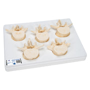 Set of 5 BONElike Lumbar Vertebrae