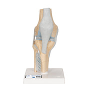 Sectional Human Knee Joint Model, 3 part