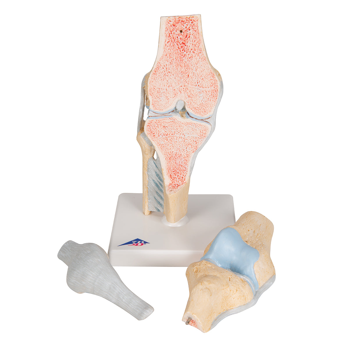 Sectional Human Knee Joint Model, 3 part