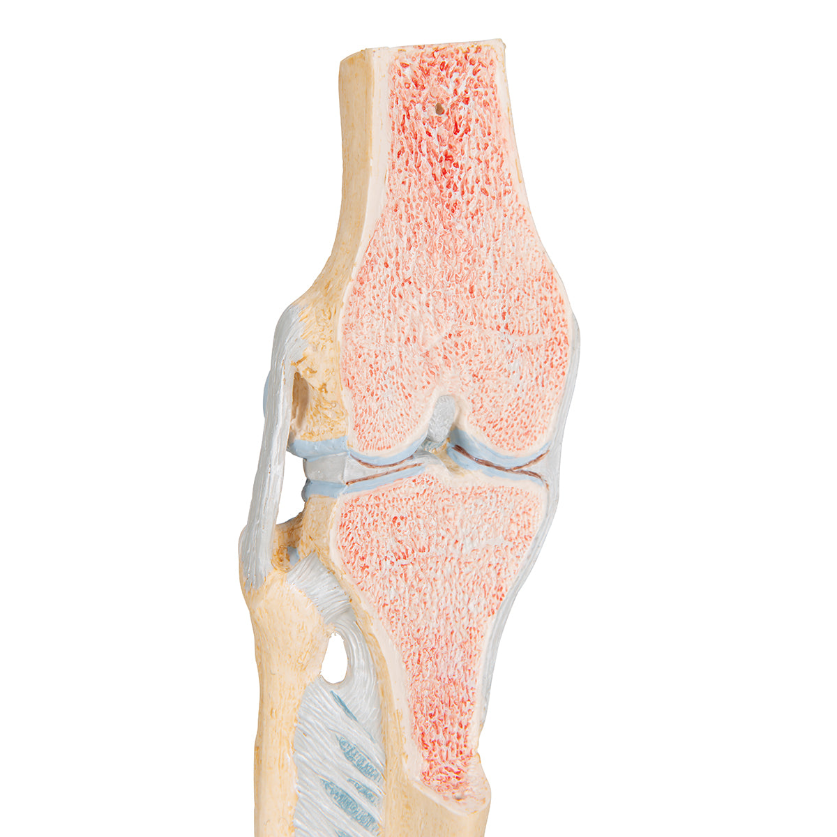 Sectional Human Knee Joint Model, 3 part