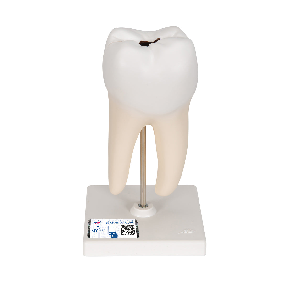 Lower Twin-Root Molar with Cavities Human Tooth Model, 2 part