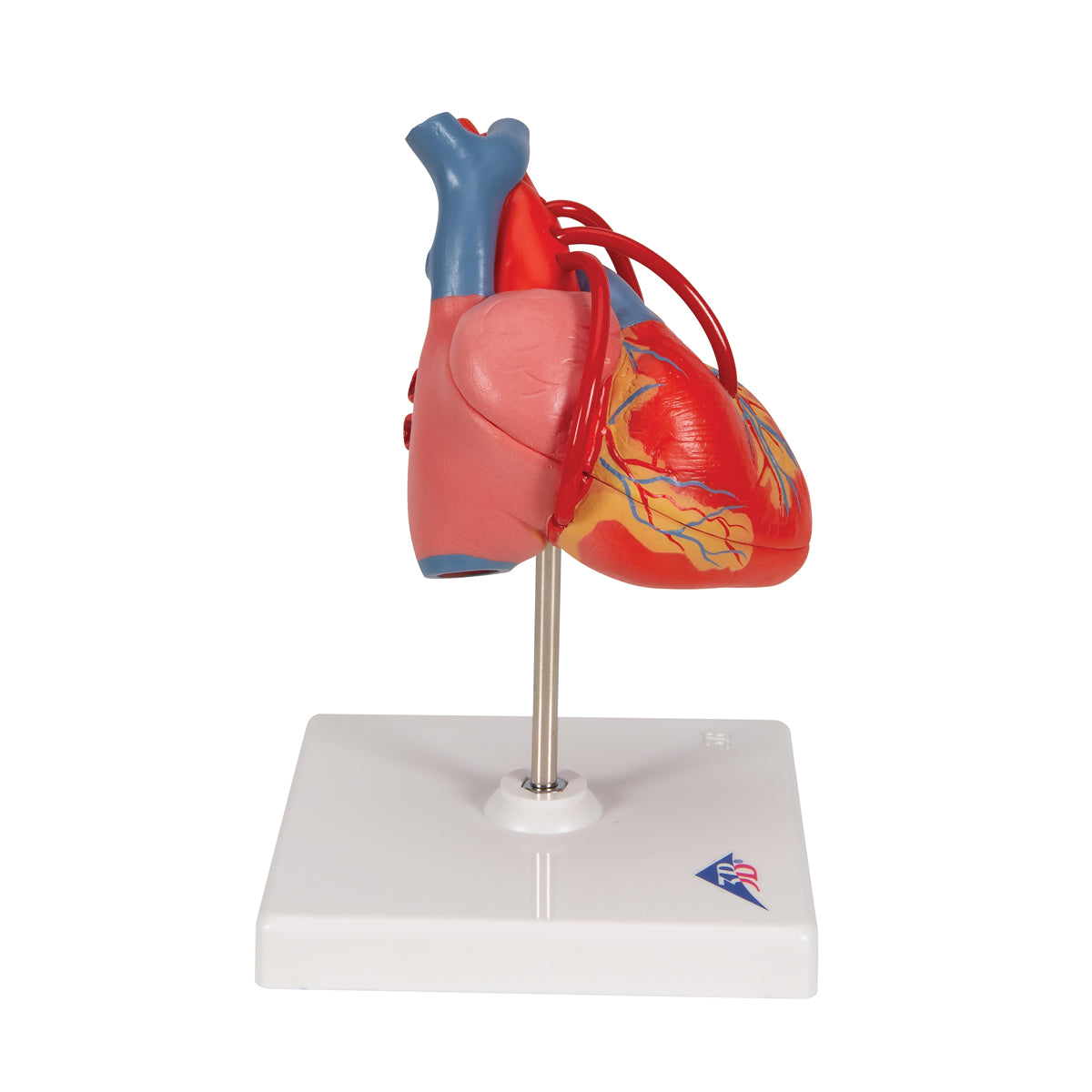 Classic Human Heart Model with Bypass, 2 part