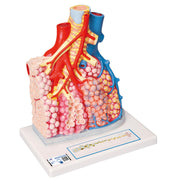 Model of Pulmonary Lobule with Surrounding Blood Vessels, 130 times Magnified