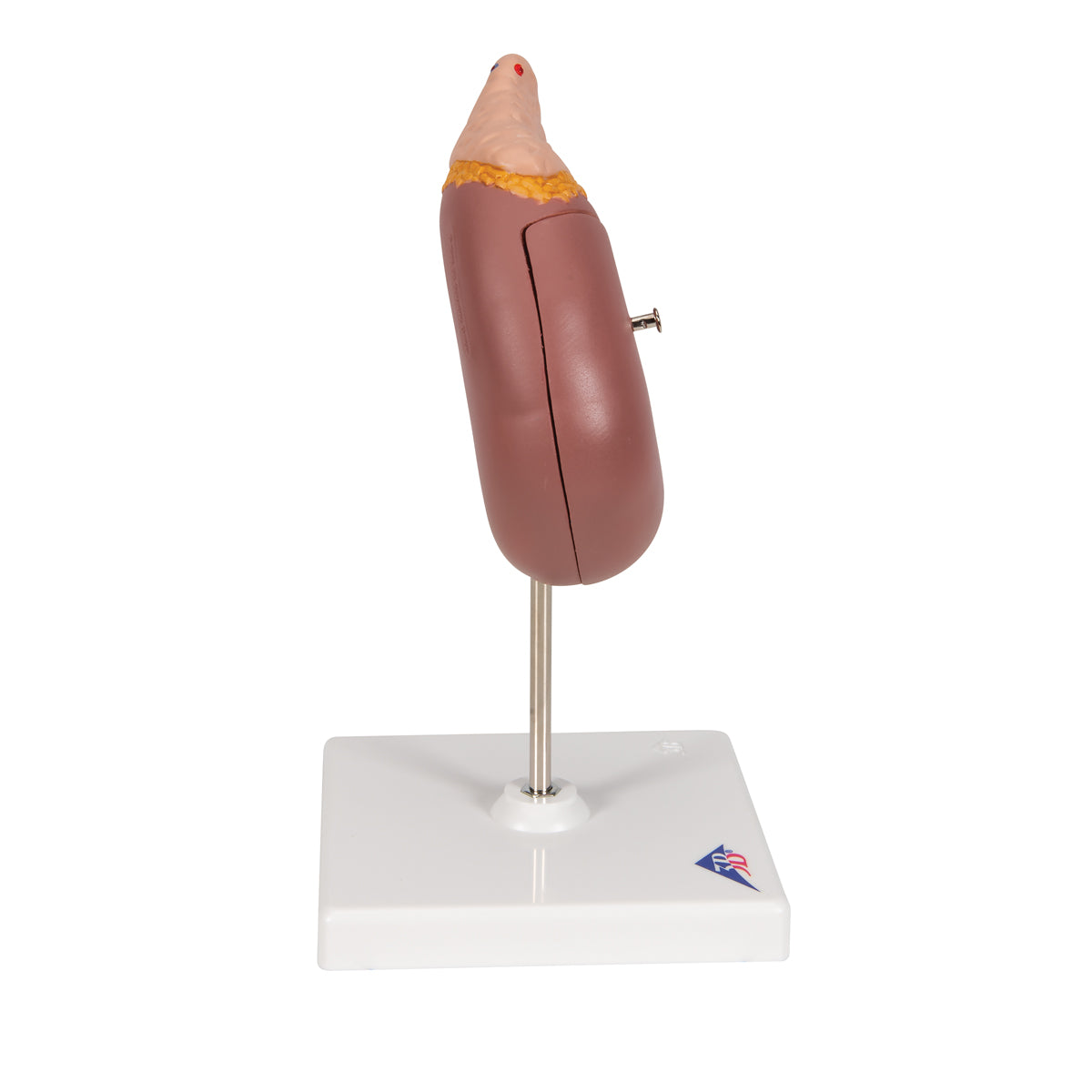 Kidney Model with Adrenal Gland, 2 part