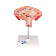 Fetus Model, 4th Month in Abdominal Position