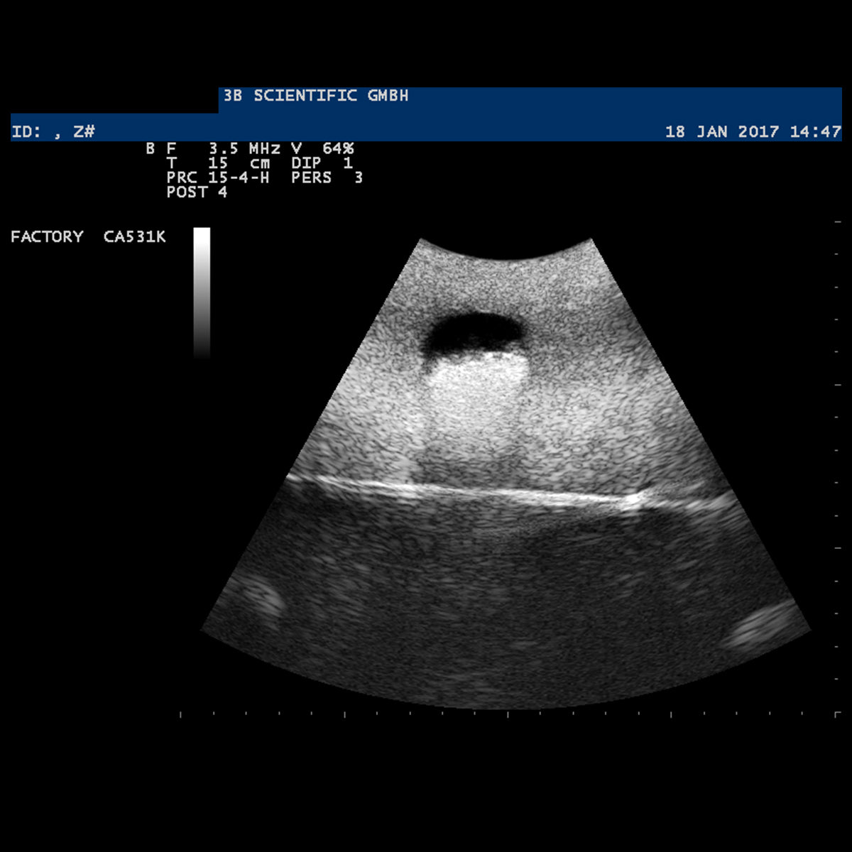 SONOtrain Ultrasound Vein Model, Light Skin