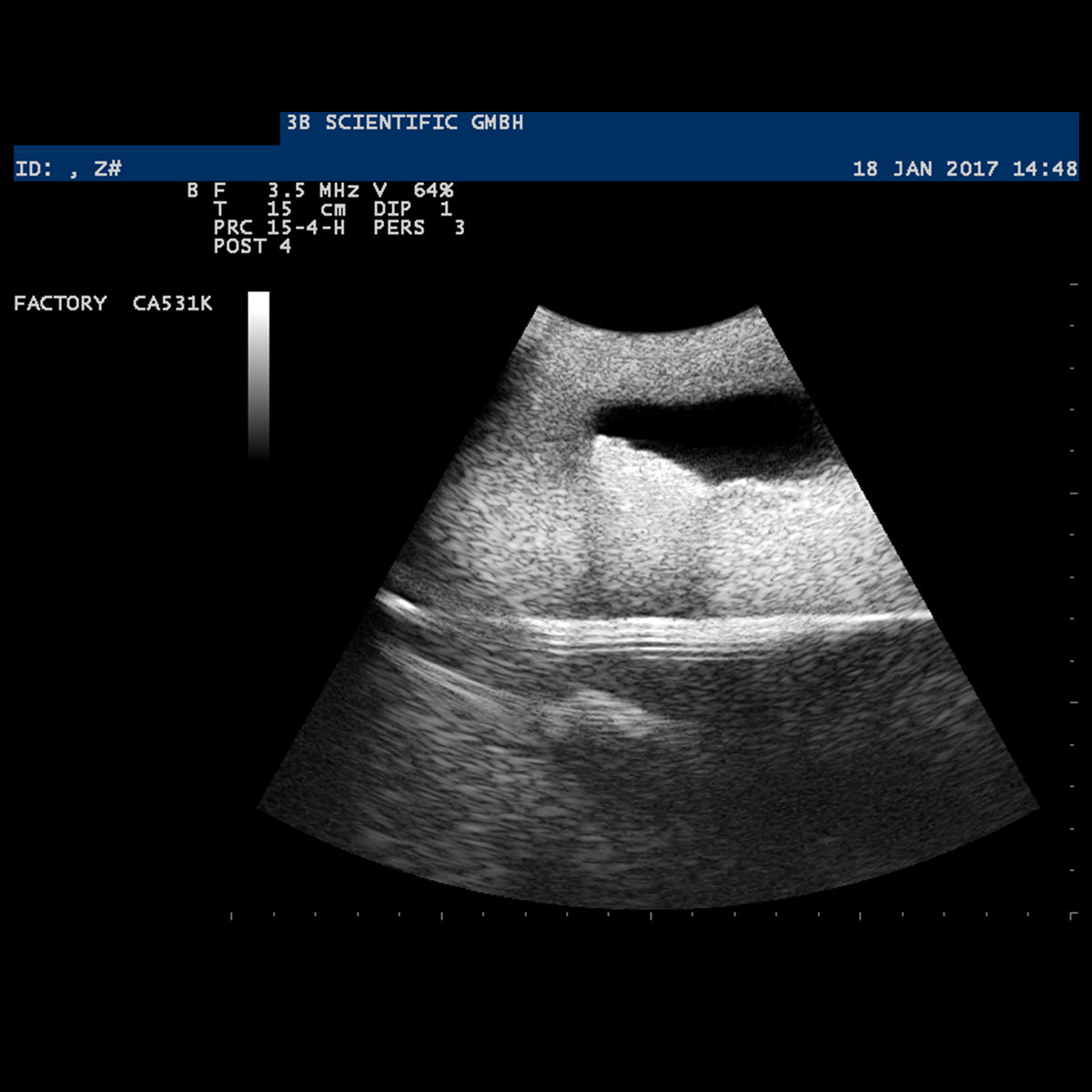 SONOtrain Ultrasound Vein Model, Light Skin