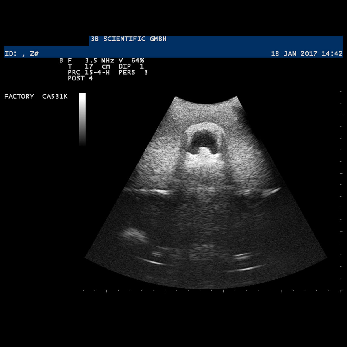 SONOtrain Ultrasound Vein Model, Light Skin