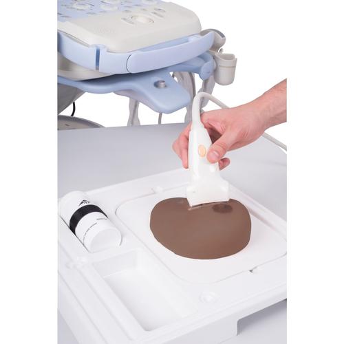 SONOtrain™ Breast with Tumours, Dark