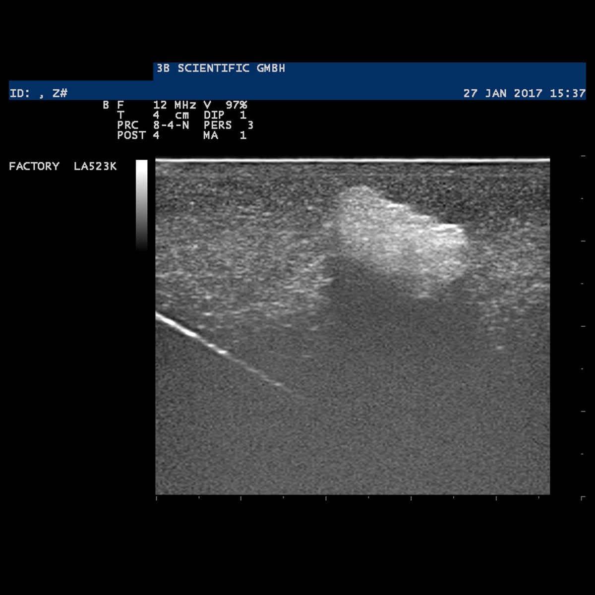 SONOtrain Breast model with tumours, Light Skin