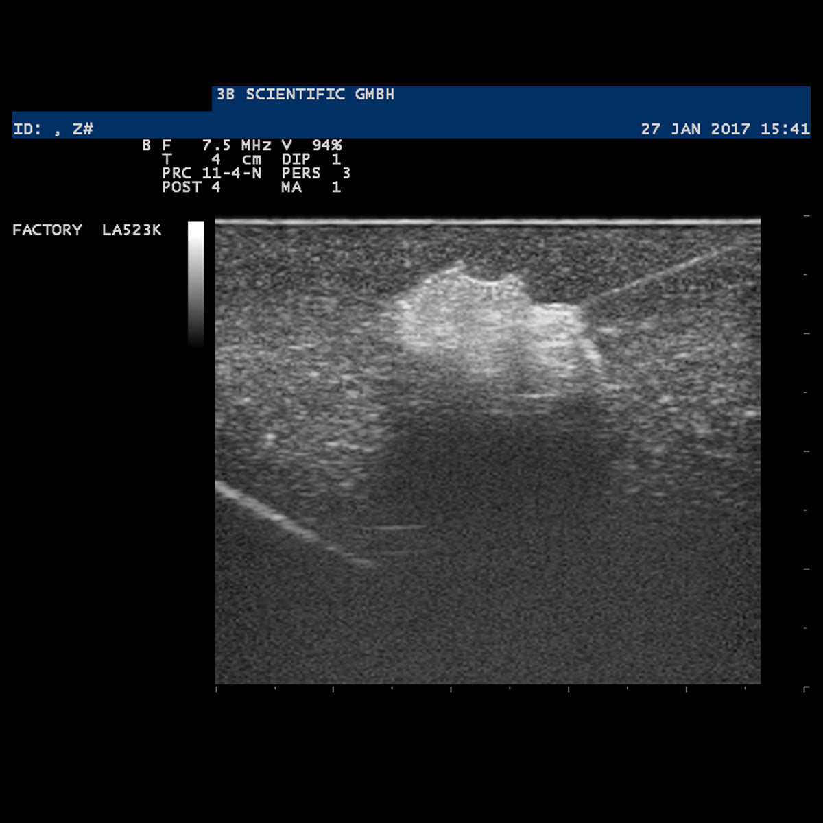 SONOtrain Breast model with tumours, Light Skin