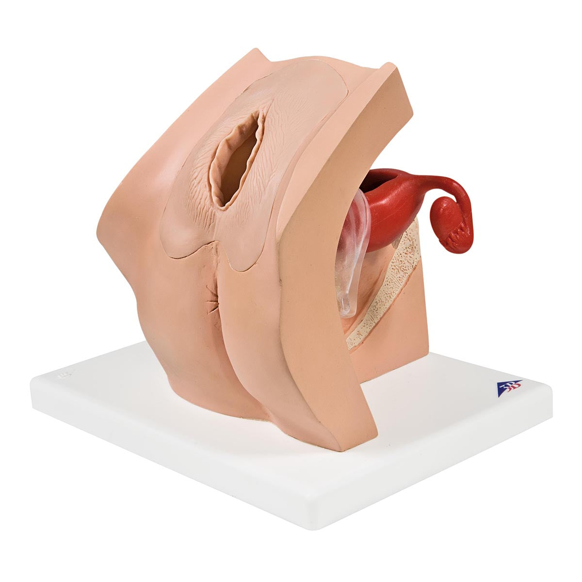Model for GynaecologicalPatient Education