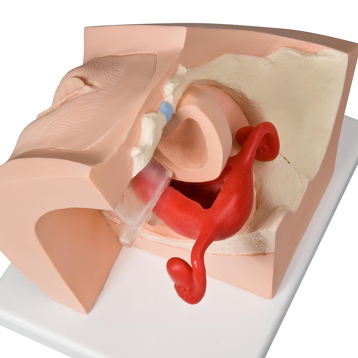 Model for GynaecologicalPatient Education