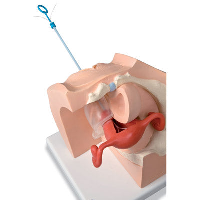 Model for GynaecologicalPatient Education